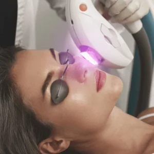 Face Laser Hair Removal