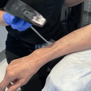 Morpheus Arms / Bat Wings