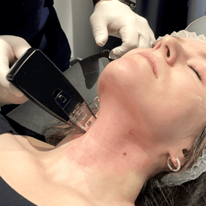 Morpheus Face + Neck