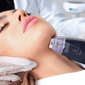 Morpheus Jawline Contouring