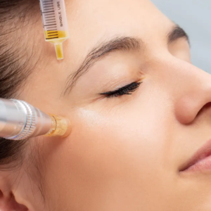 Prp with  Microneedling Serum