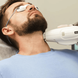 Beared Line Laser Hair Removal