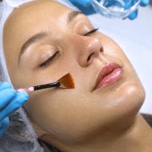 Body Peel  (Per Part)