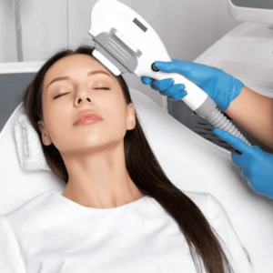 Forehead Laser Hair Removal