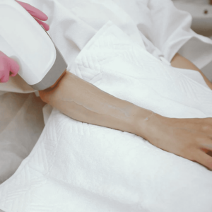 Full Arms Laser Hair Removal