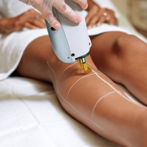 Full Legs Laser Hair Removal