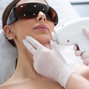 Half Face Laser Hair Removal