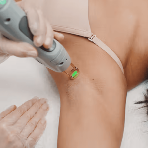 Under Arm Laser Hair Removal
