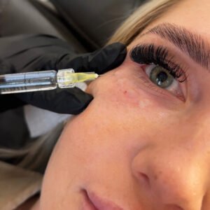 Polynucleotide (Under Eye)