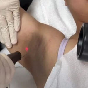 Pico Q Switch Under Arm