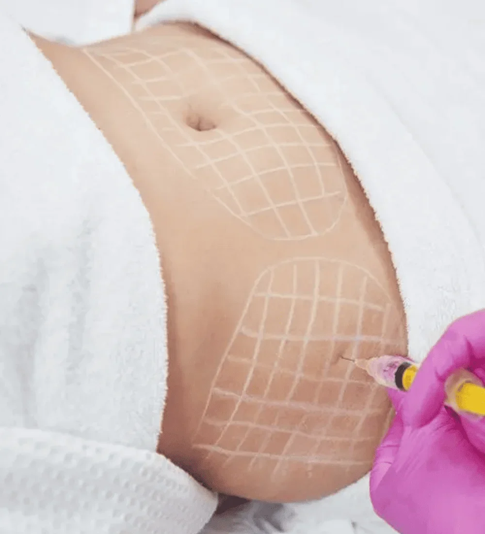 lipolytic-r57ljx44ul3udjv4e392858pjlyl7bz253nimzp914