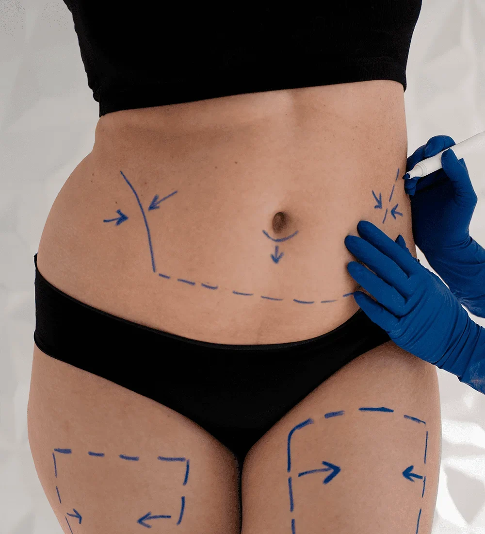 stomach-liposonix-r1mtgzq09b21yrv9wlzf80b6u7j4bdstc3v5eceku0