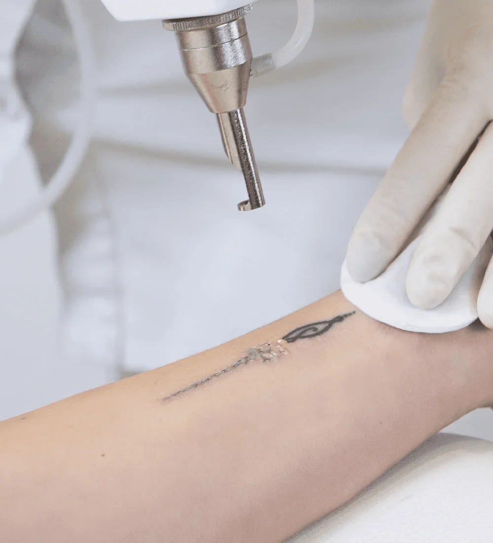 tatto-r57pua5z74f107n70tbfp6xthl4l9ws614i3uutr7c